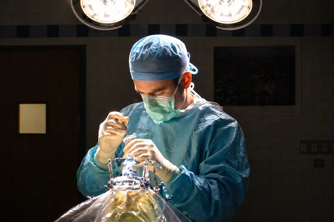 Robotic and image-guided equipment used for DBS surgery