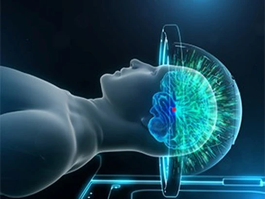 Ultrasound beams converging through the skull on a target deep in the brain