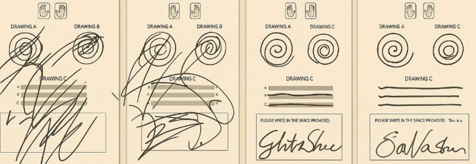 Spiral and handwriting samples taken between sonications during treatment